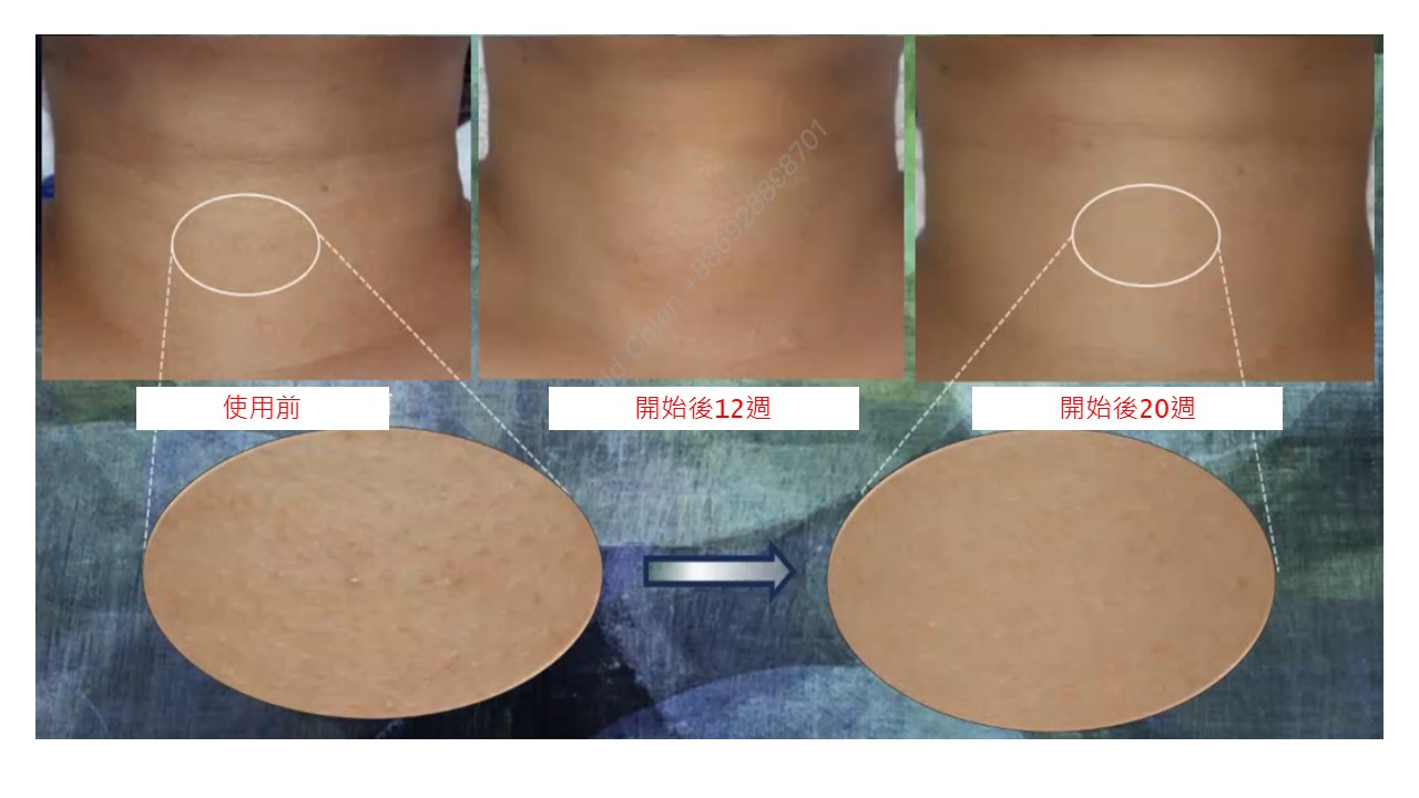 LifeRegen公司介紹