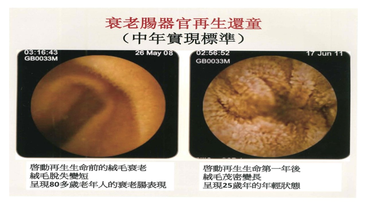 LifeRegen公司介紹