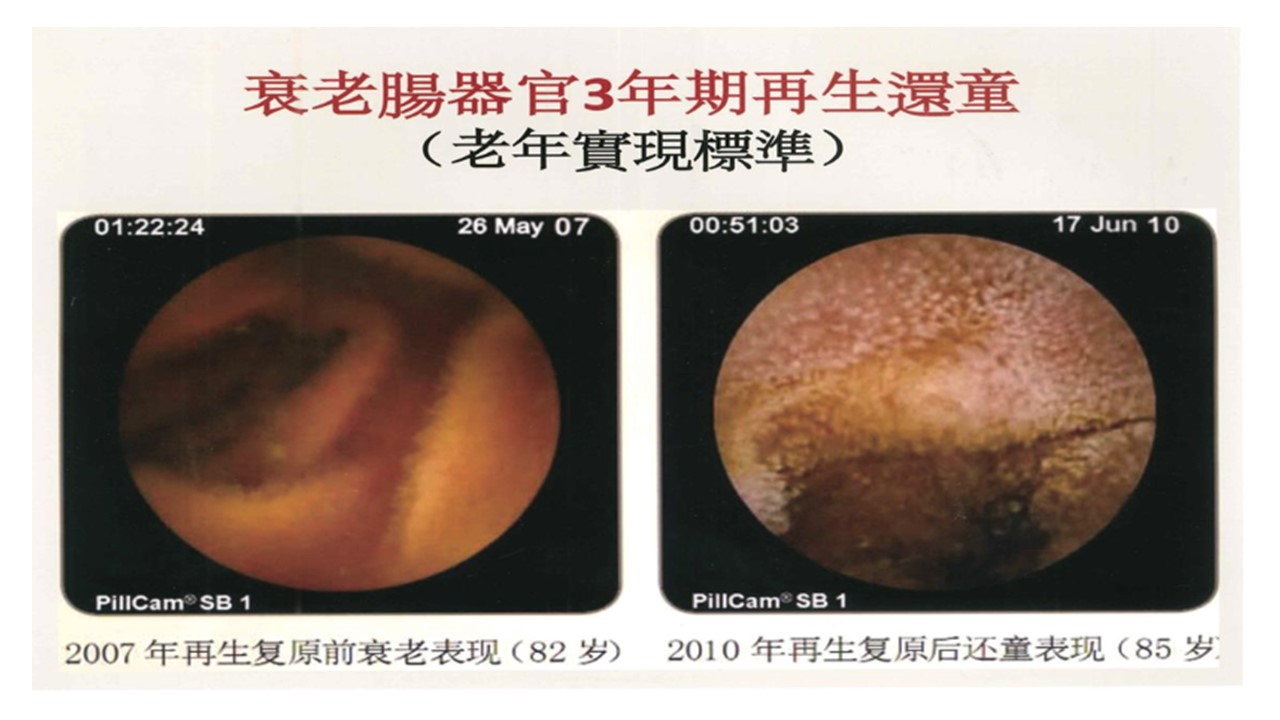 LifeRegen公司介紹