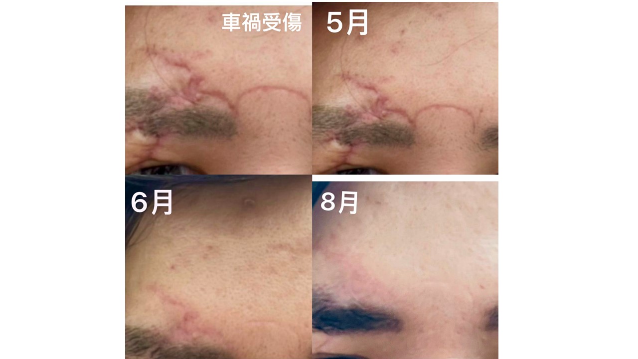 LifeRegen公司介紹