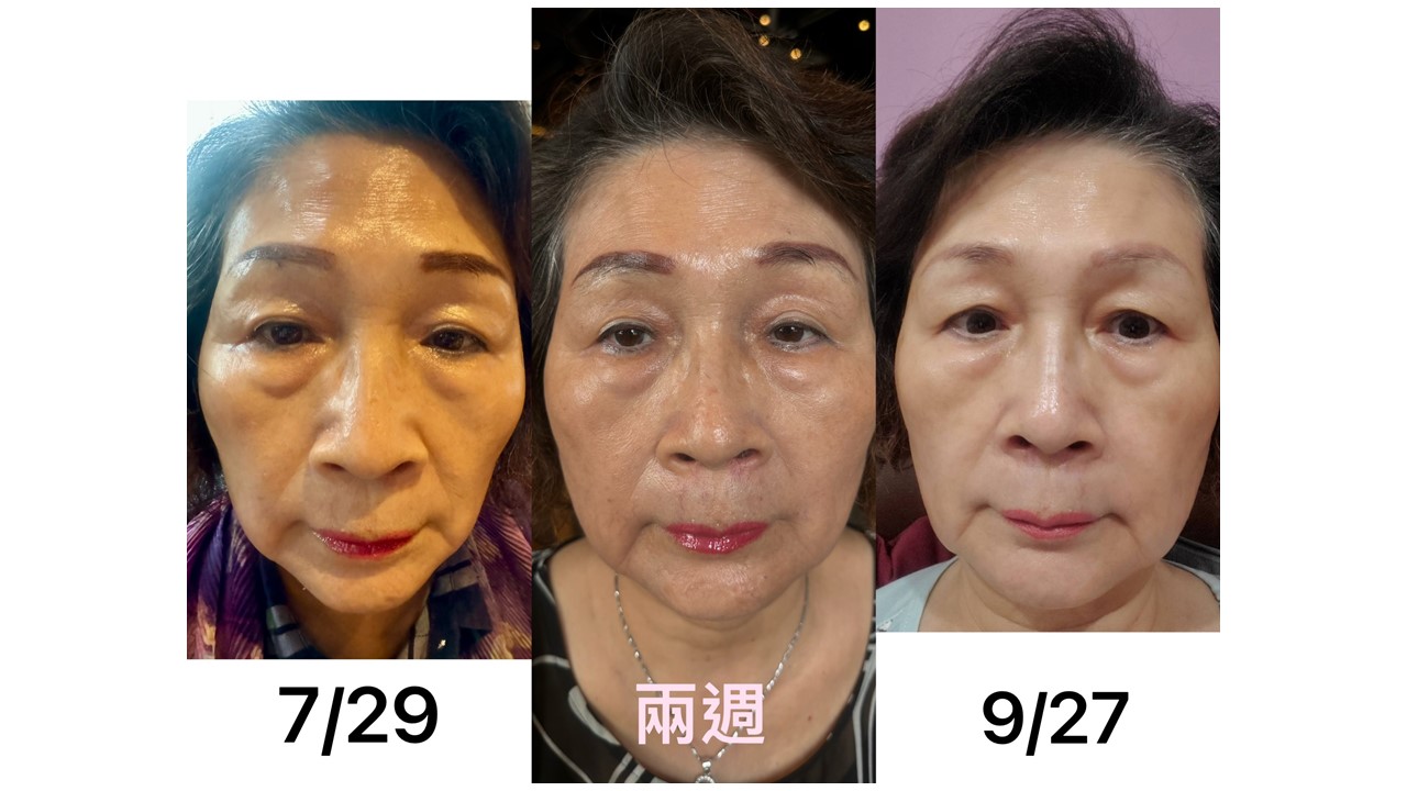 LifeRegen公司介紹