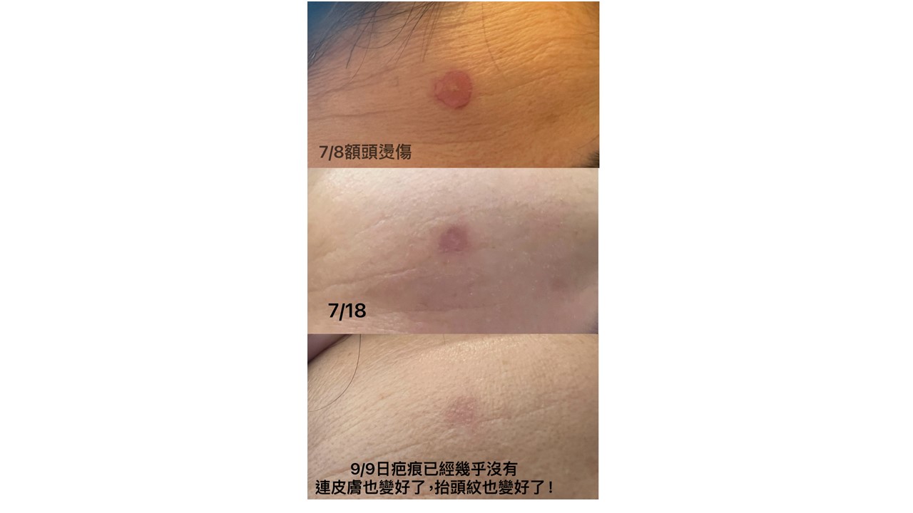 LifeRegen公司介紹